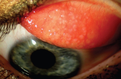 Senelerdir Lens mi Kullanıyorsun